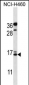 BGLAP Antibody (Center)